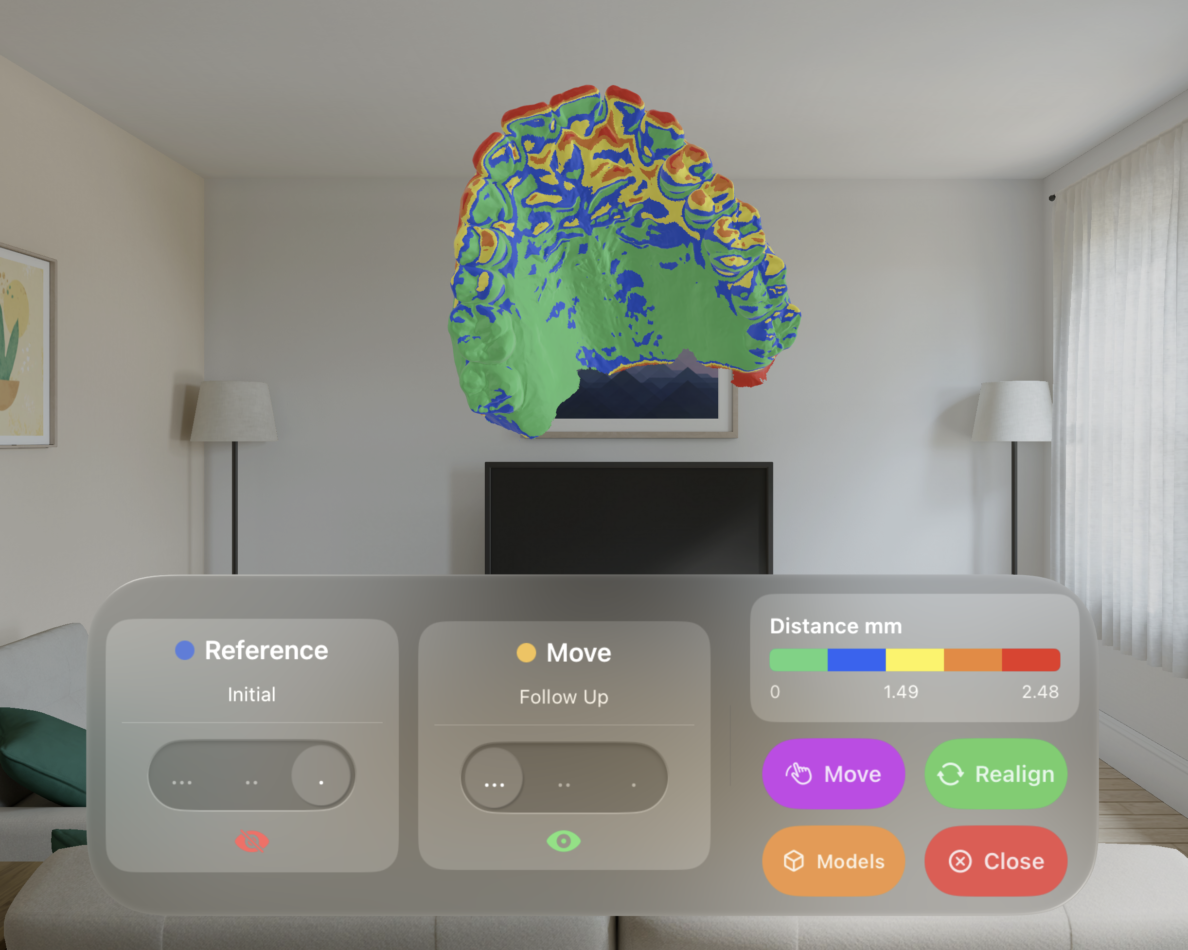 Color map dental model